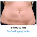 B&A-Becker-AB-3Set-17wk-HiRes