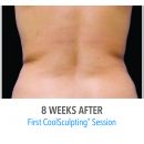 B&A-Behroozan-FL-3Set-16wk-HiRes