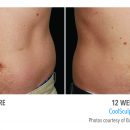 B&A-DiBernardo-AB-2Set-12wk-HiRes
