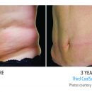 B&A-Eviatar-FL-2Set-3yr-3Q-HiRes