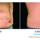B&A-Haynes-AB-pt01-2Set-8wk-3QR-HiRes